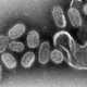 Micrografía de electrones que muestra virus Influenza causantes de la gripe.